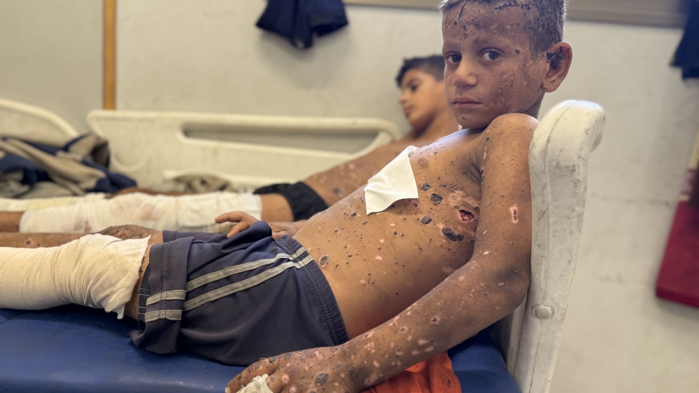  Gaza’s unexploded ordnance kills and maims : NPR