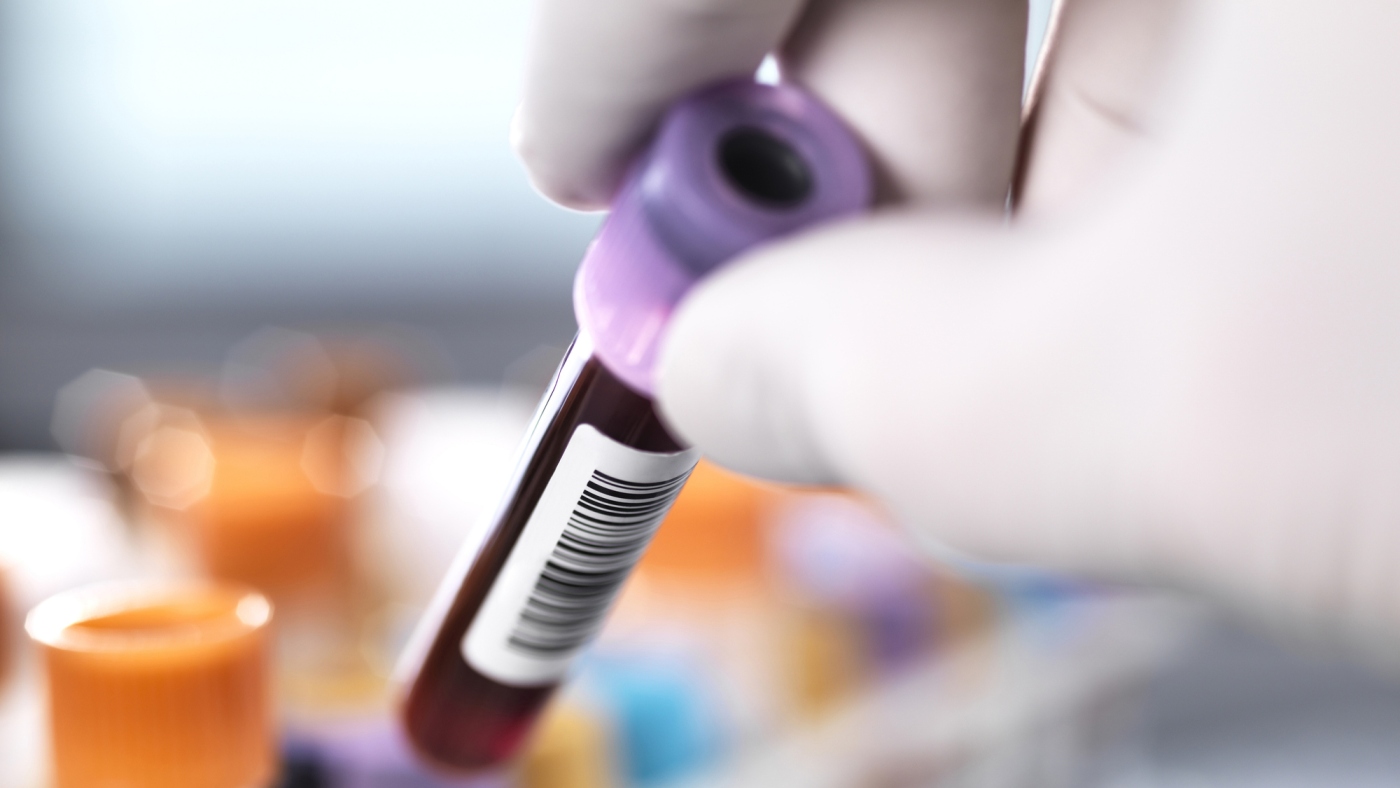  CRISPR gene-editing works to reduce high cholesterol in a new study : NPR