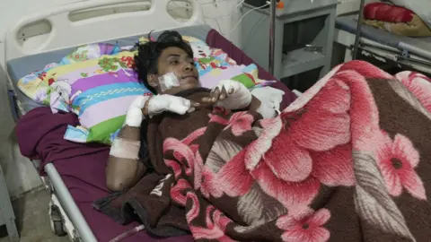 Aamir Peerzada/BBC Abel lies on a hospital bed under a floral blanket with heavily bandaged hands