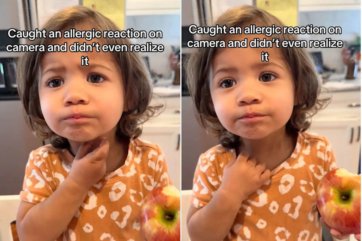  Mom Took a Video of Her Daughter Eating an Apple. She Didn’t Realize She Was Capturing an Allergic Reaction (Exclusive)