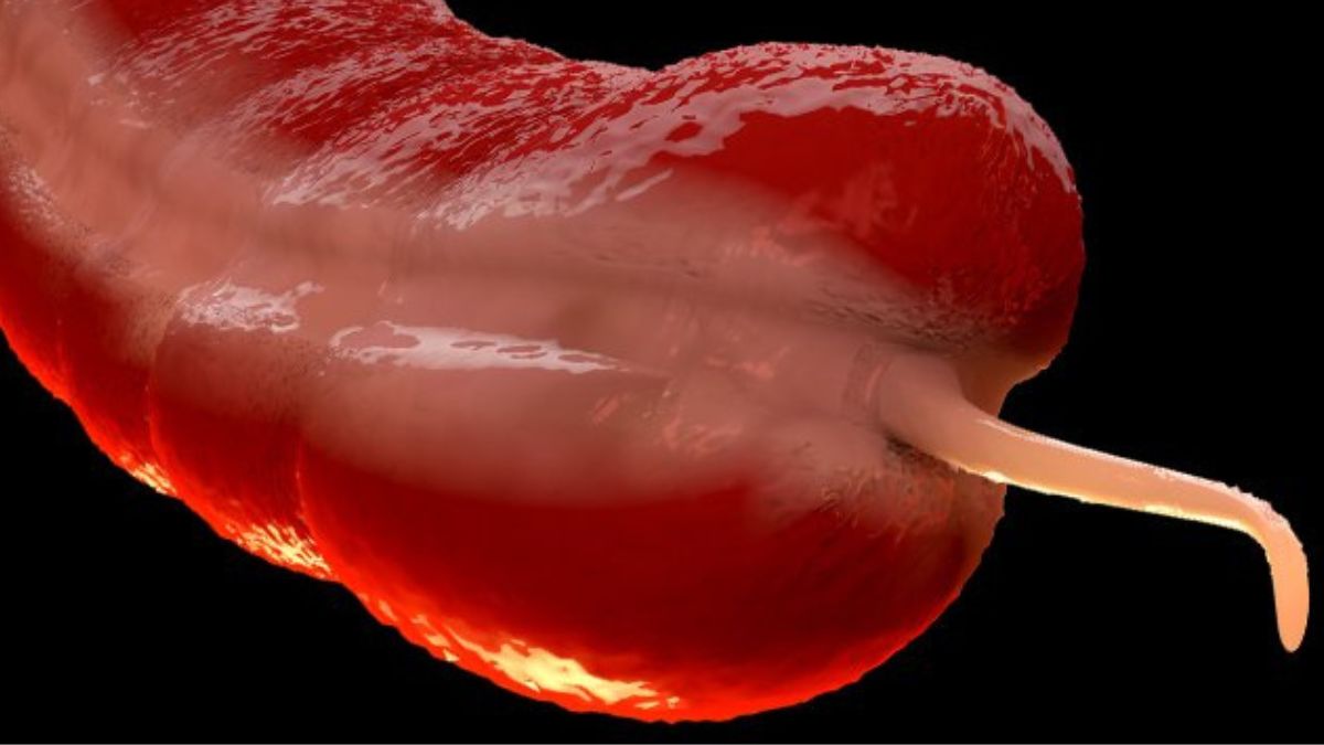  A Rare Cancer Is Surging in Young People, And Experts Are Puzzled : ScienceAlert