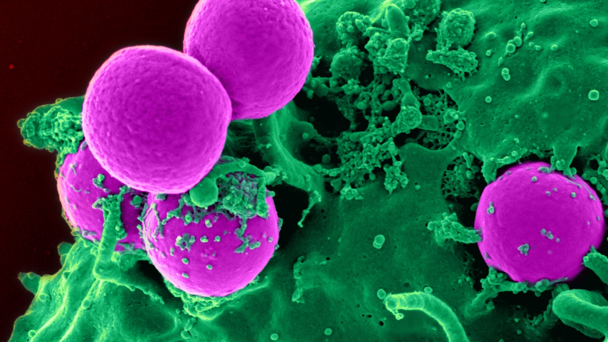  Grim Signals of Future Antimicrobial Resistance Found Lurking in Sewage : ScienceAlert