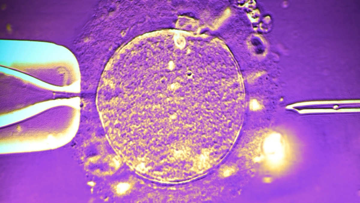  Sperm Donor With Rare Cancer-Risk Gene Fathers Nearly 200 Children : ScienceAlert