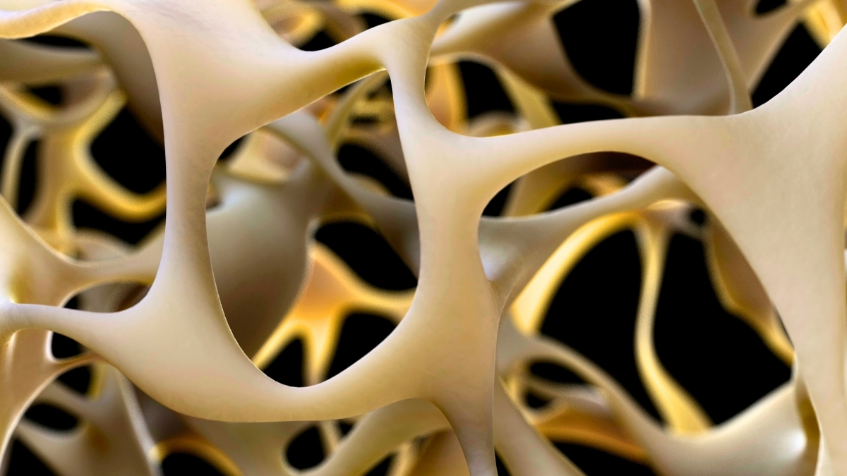  New Breakthrough to Strengthen Bone Could Reverse Osteoporosis : ScienceAlert