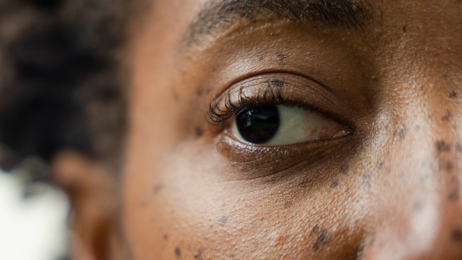  Injecting anesthetic into a ‘lazy eye’ may correct it, early study suggests