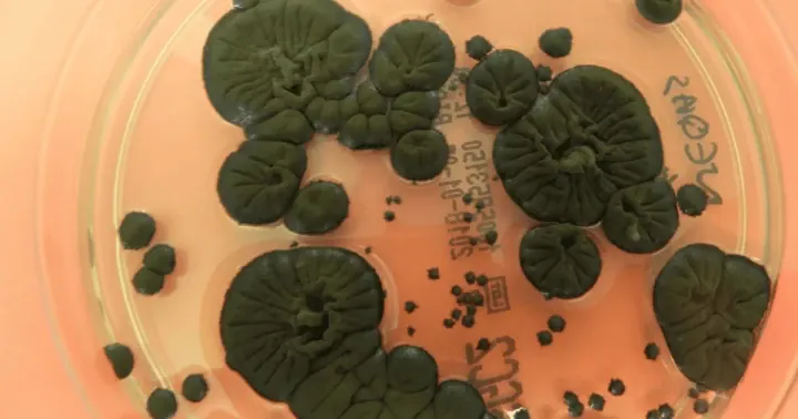 Melanized Cladosporium sphaerospermum fungus. (Source: Rui Tomé / Atlas of Mycology)