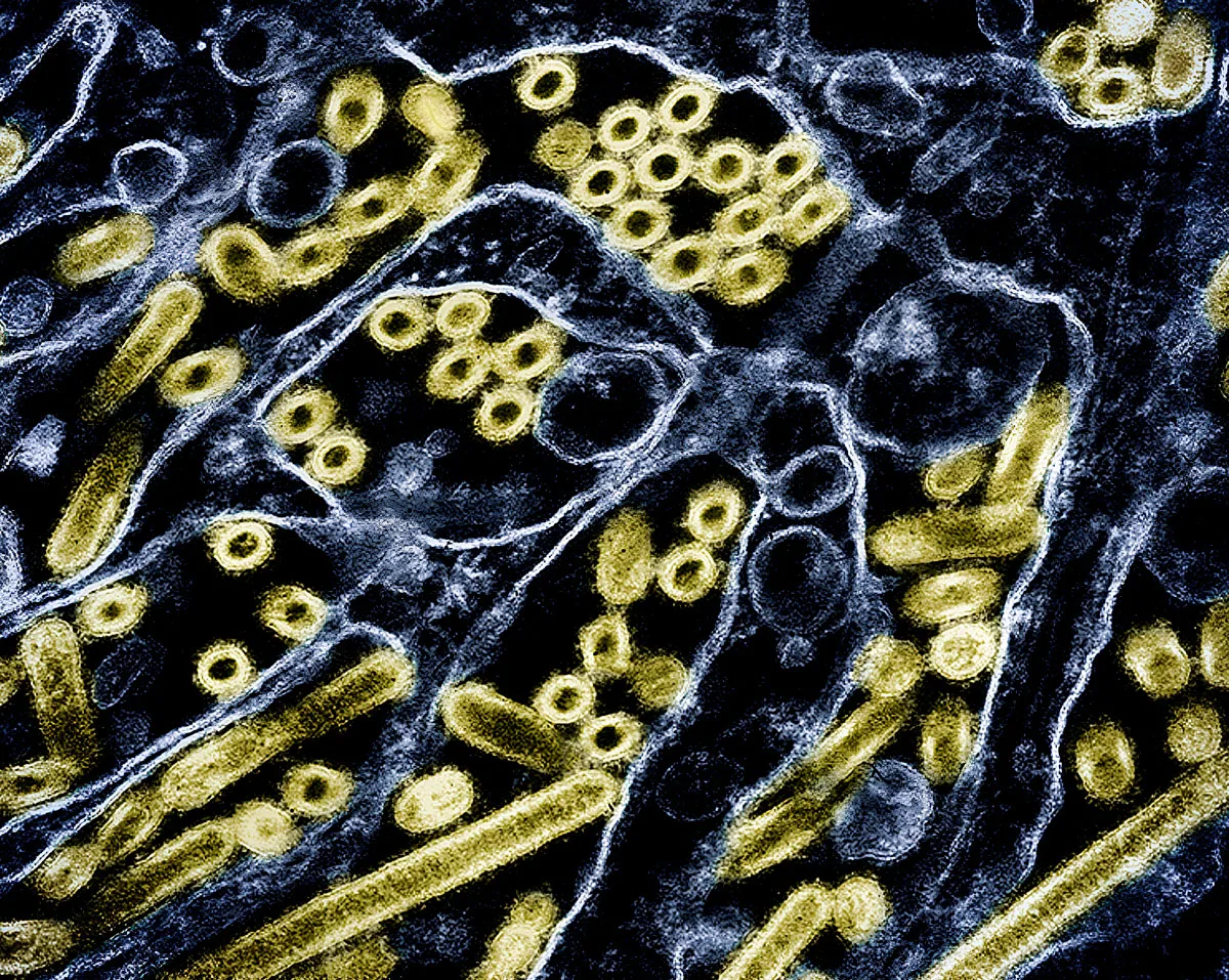 Colorised transmission electron micrograph of avian influenza A H5N1 virus particles (gold).