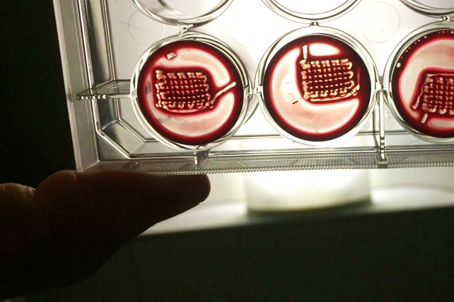 New Breakthrough to Strengthen Bone Could Reverse Osteoporosis