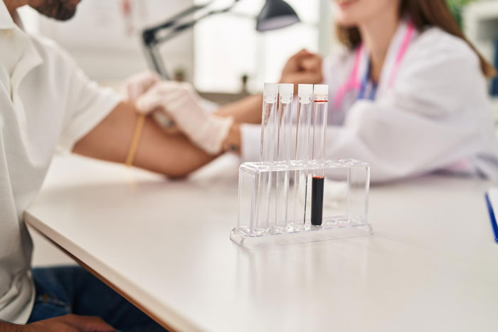 Blood samples in test tubes on a lab table with a medical professional drawing blood from a patient's arm, diabetes testing context. Blood samples in test tubes on a lab table with a medical professional drawing blood from a patient's arm, diabetes testing context.