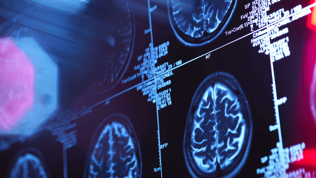  Seattle-based AI start-up aims to help with cognitive decline