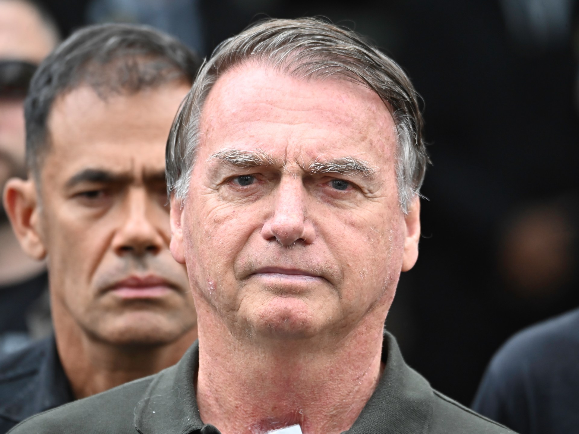  Brazil’s jailed ex-President Bolsonaro undergoes ‘successful’ surgery | Jair Bolsonaro News
