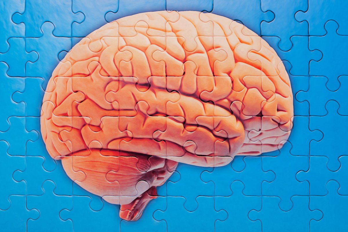  Scientists Identify Possible Game Changing Treatment for Alzheimer’s Disease That Could Control It Like High Cholesterol