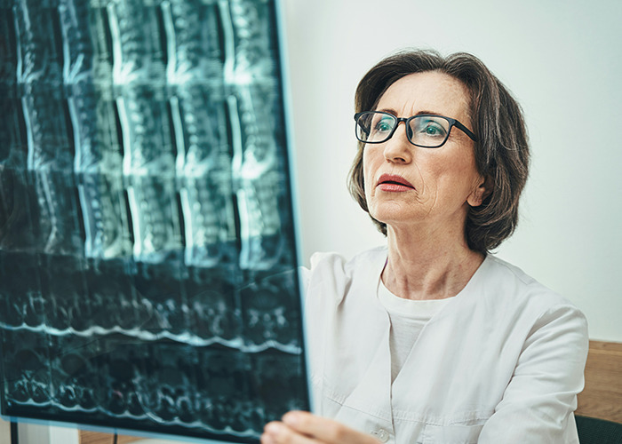 Female expert wearing glasses examines bone tissue X-rays, highlighting concerns about microplastics in bone health research.