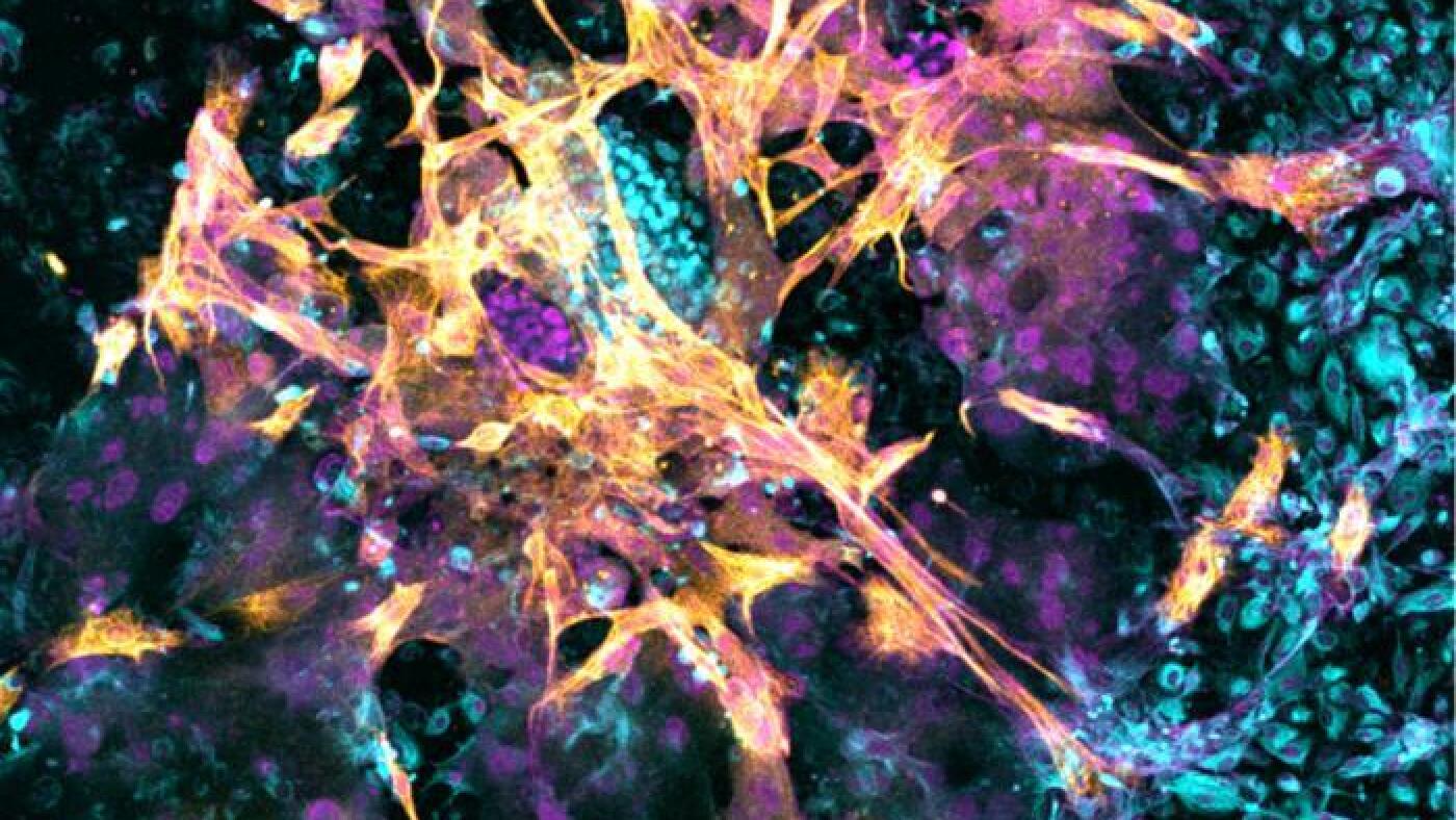  Scientists learn more about how human embryos implant using artificial wombs : NPR