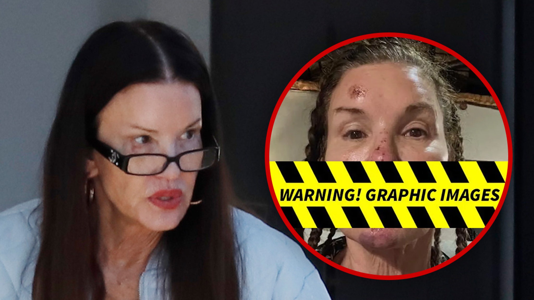  Janice Dickinson Spotted After Sharing Alleged Injuries From Reality Show Fall