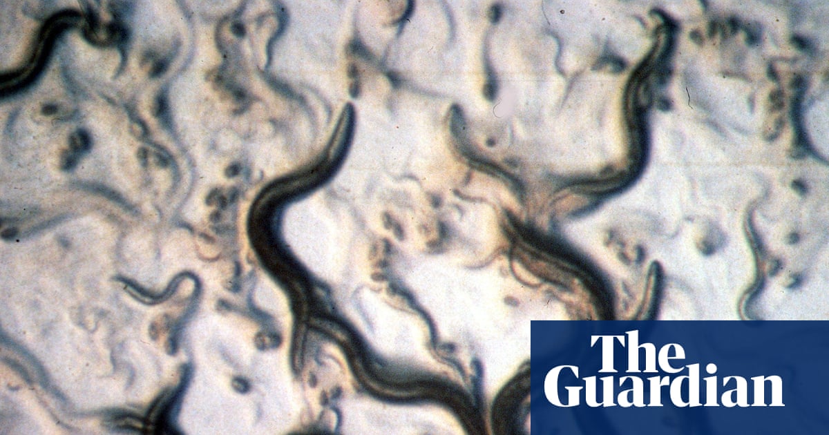  Does it even need to be said? No, you don’t need to do a ‘parasite cleanse’ | Well actually