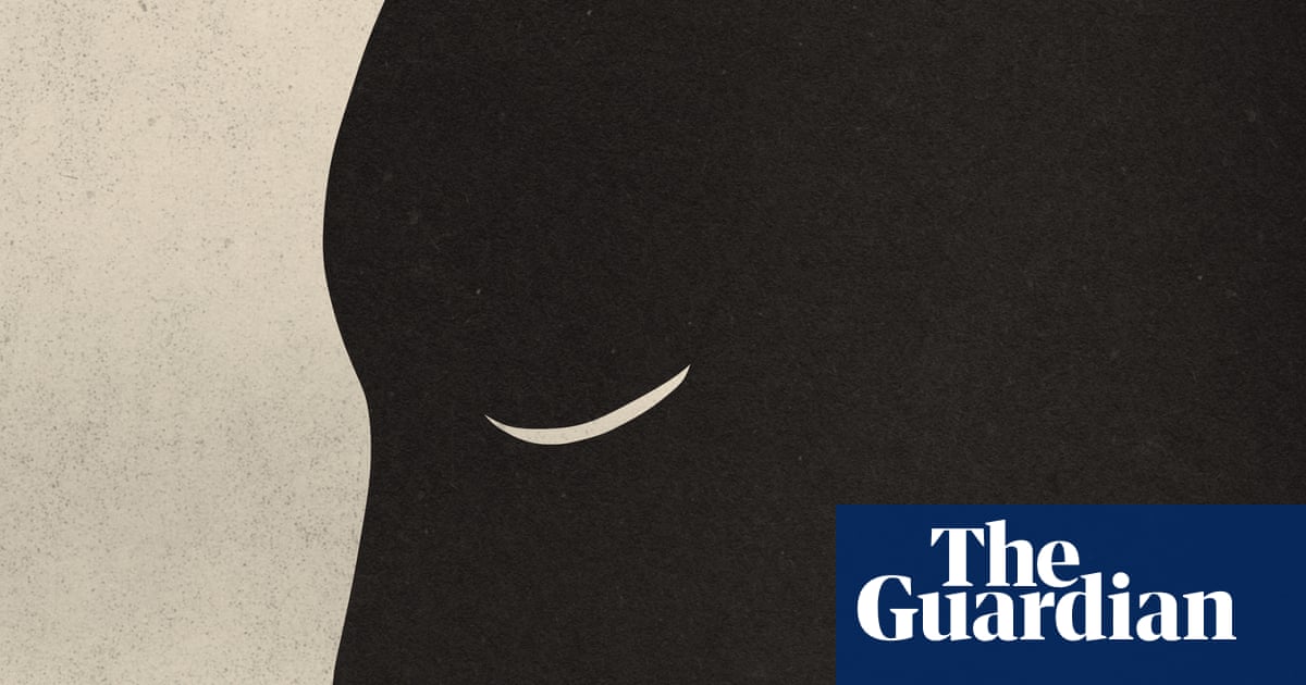  I have frequent nosebleeds. What causes it and is it normal? | Well actually