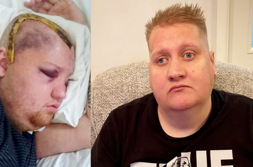  ‘It’s a nightmare’: UK man sues NHS after receiving eight years of chemotherapy instead of six months |