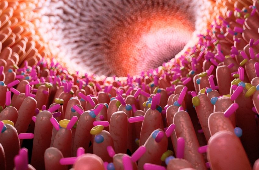  Gut Inflammation Link to Alzheimer’s Disease Confirmed Once Again : ScienceAlert