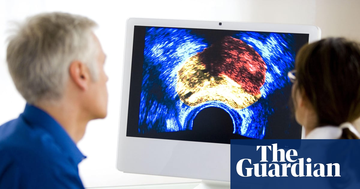  Prostate cancer is most commonly diagnosed cancer across UK, study finds | Cancer