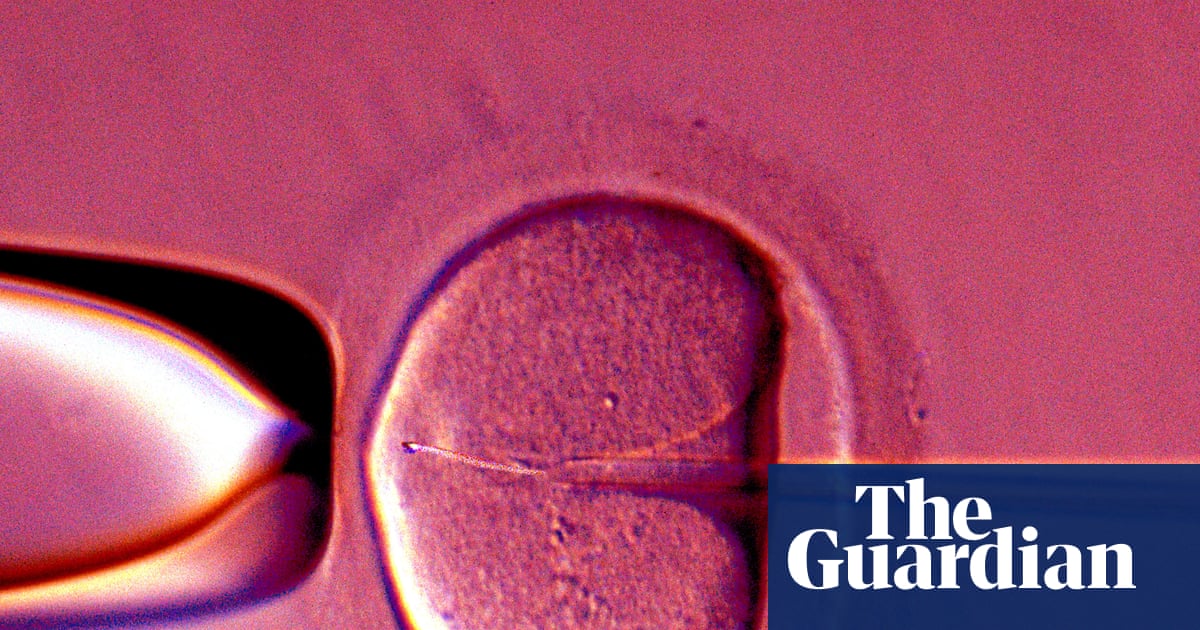  Human eggs ‘rejuvenated’ in an advance that could boost IVF success rates | Medical research