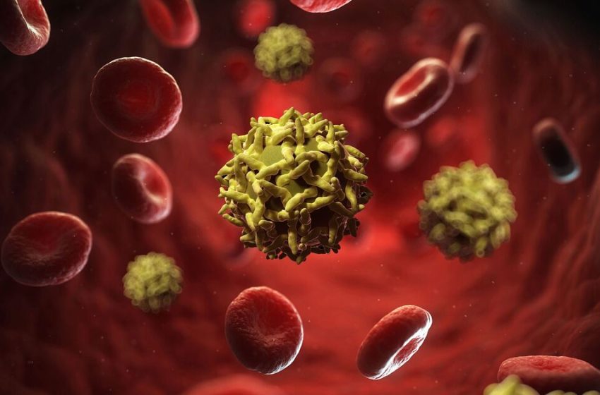  Horror outbreak of ‘yellow jack’ disease leaves 70 dead | World | News