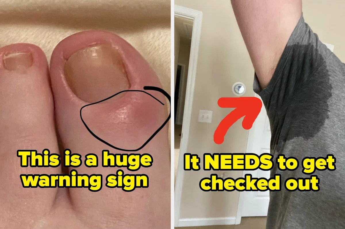  Medical Professionals Are Revealing The “Small” Health Signs You Should Never, Ever Ignore