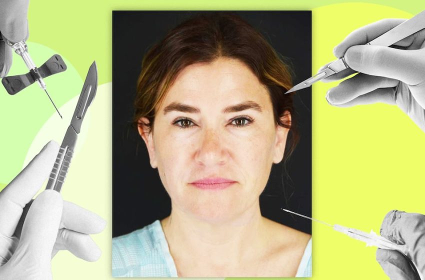  How This Woman in Her Late 40s Got Dramatic Results Without a Facelift