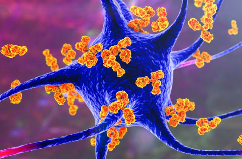  Forever Chemicals Linked to Multiple Sclerosis in Concerning New Study : ScienceAlert