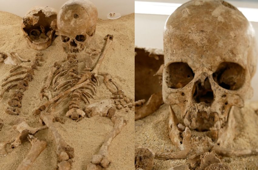  Teenage girl who lived in Italy 12,000 years ago had a rare form of dwarfism, DNA study shows
