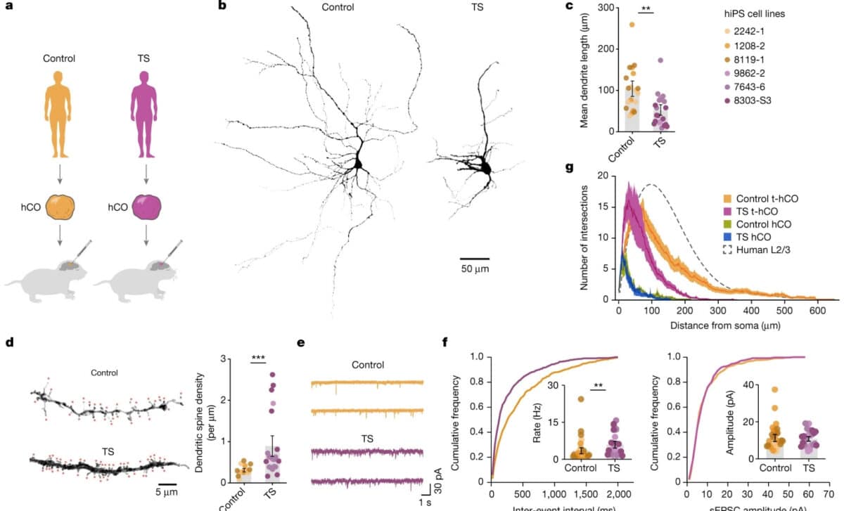 Advanced Neuronal Features In T Hco Reveal Activity Dependent Disease Phenotypes In Human Cortical Neurons