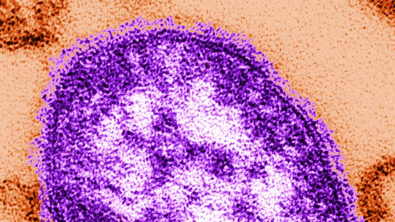  As a measles outbreak burns through South Carolina, not enough people are getting vaccinated