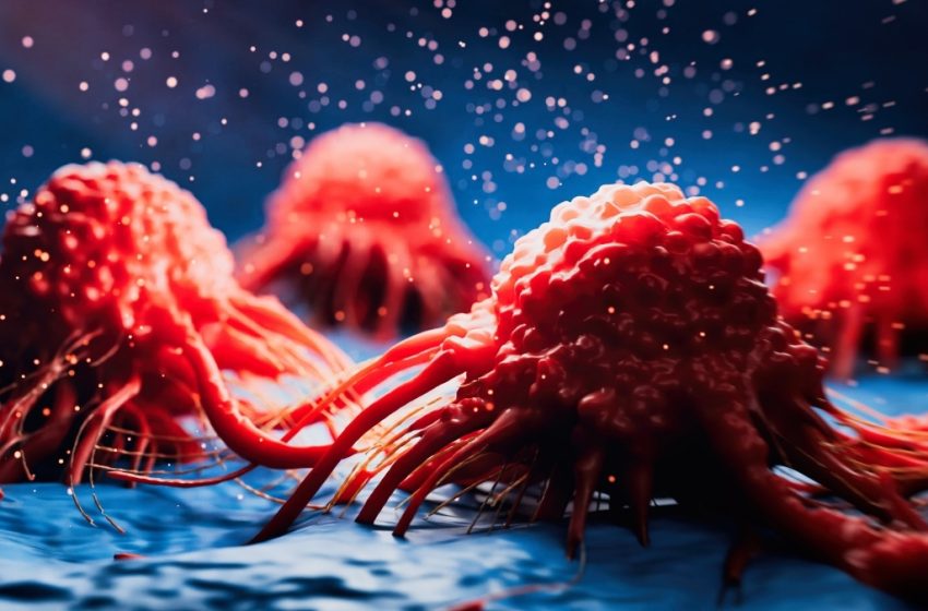  Cancer May Emit Signals That Protect The Brain Against Alzheimer’s : ScienceAlert