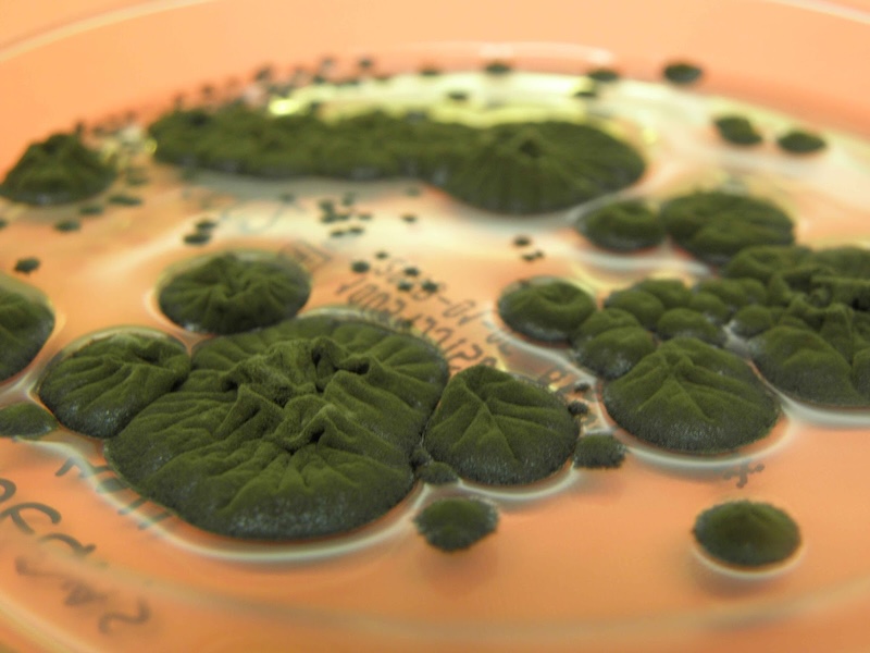 Chernobyl Black Fungus