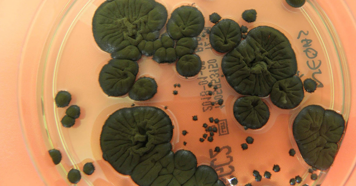  Chernobyl’s Radiation-Thriving Fungus Surprises Scientists