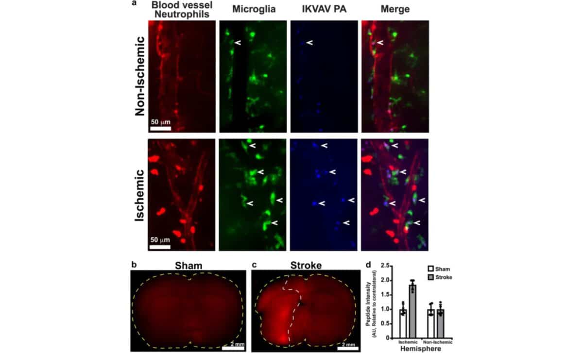 Fluorescent Imaging Shows Ikvav Pa Nanomaterials Targeting Stroke Damaged Brain Tissue 24h After Injection. © Neurotherapeutics