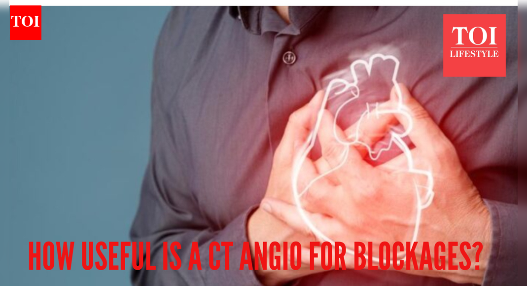  Do you really need a CT Angiography to detect heart blockages? Leading doctor busts some myths