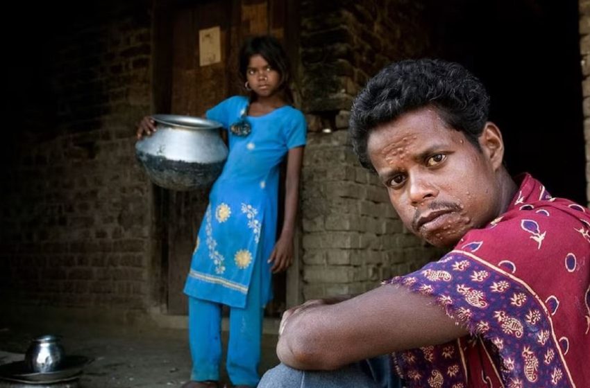  Communities unite to address stigma and discrimination affecting people with neglected tropical diseases