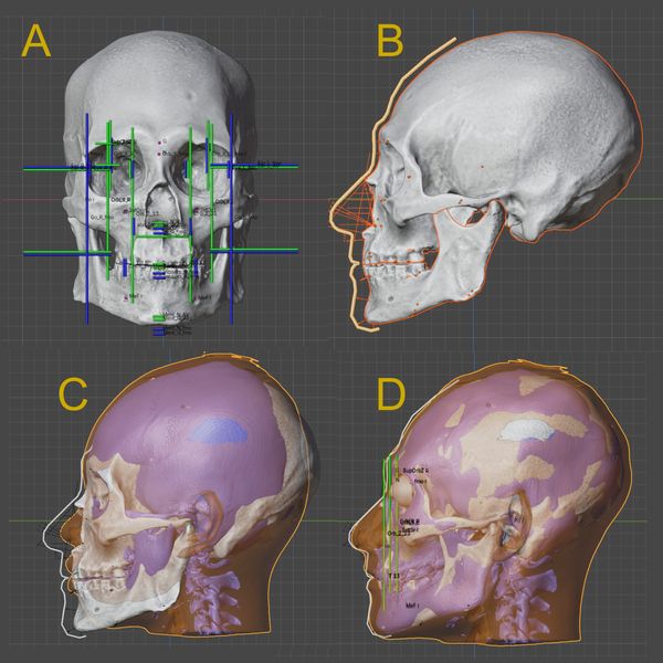 The reconstruction of the face of the Kennewick Man in progress. Pic: Cicero Moraes