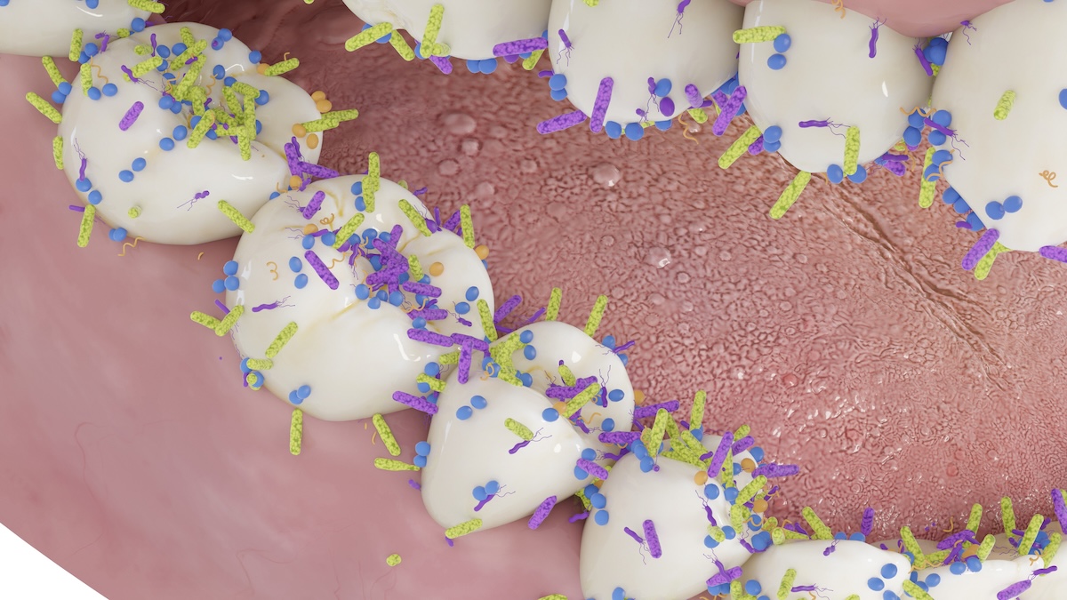  The Secret To Preventing Tooth Decay May Already Be In Your Mouth : ScienceAlert