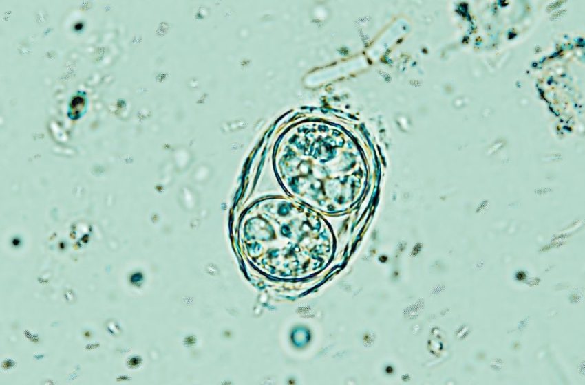  A Brain Parasite Infecting Millions Is Far Less Sleepy Than We Thought : ScienceAlert