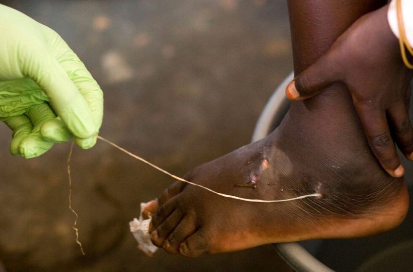  Guinea worm infections hit historic low of just 10 in 2025, Carter Center reports
