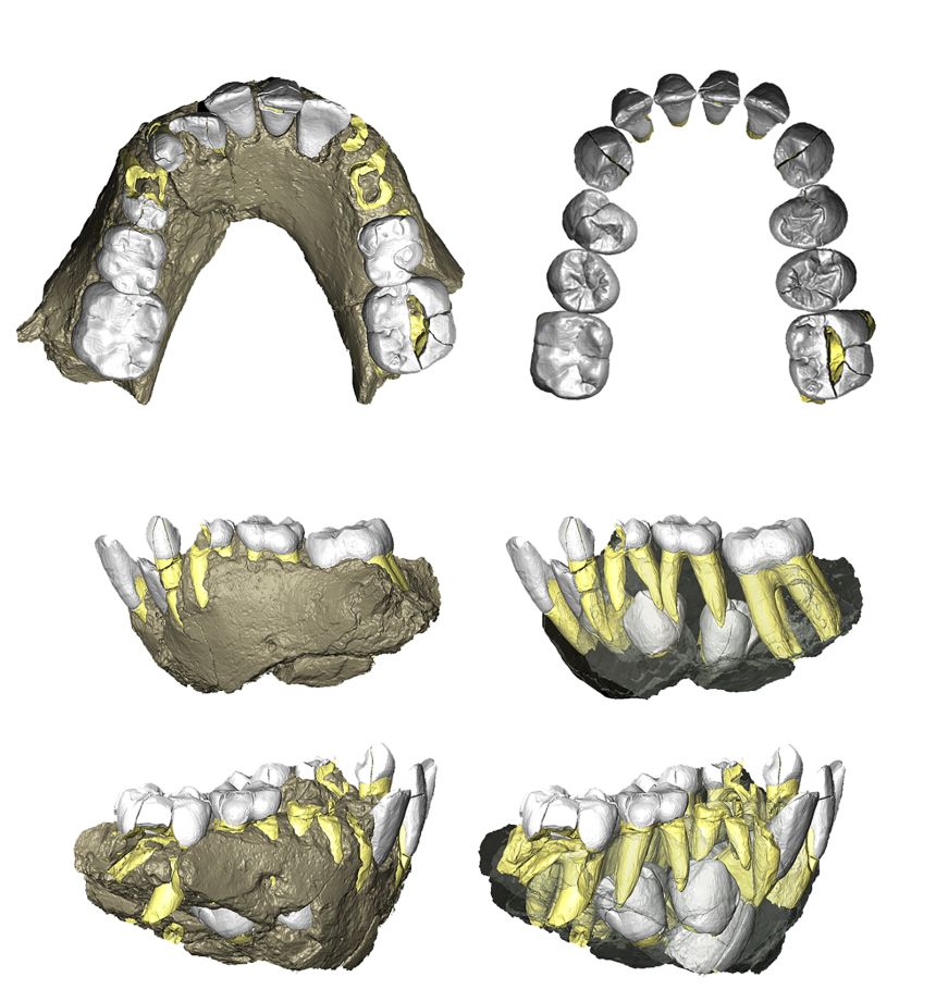 A 3D rendering of the jawbone, which belonged to a juvenile A. deyiremeda who would have been around four years old.