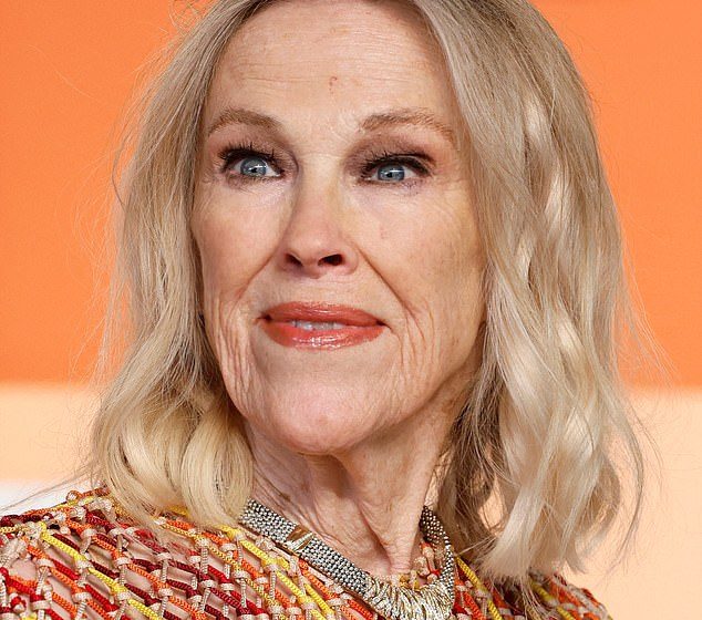  The easily missed signs of the ‘under-diagnosed’ blood clot condition that caused Catherine O’Hara’s death, revealed by a leading cardiologist – including a common mental condition and fingernail changes