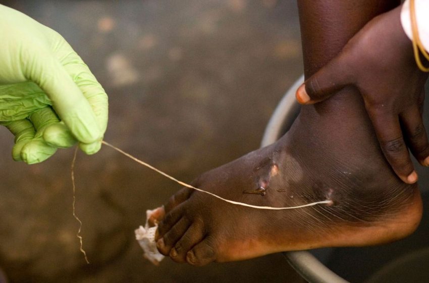  World Creeps Closer to Eradicating a Loathed Parasite