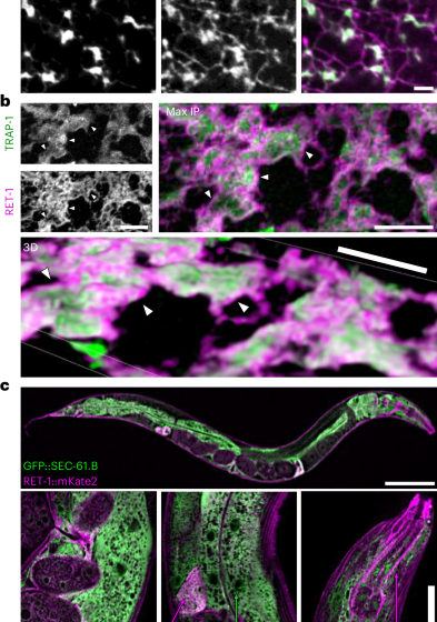  ER remodelling is a feature of ageing and depends on ER-phagy