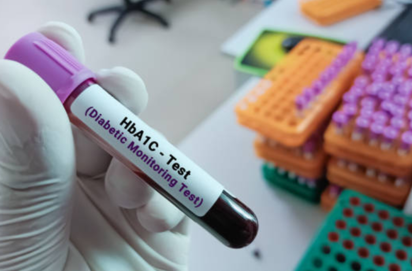  Diabetes: Relying on HbA1c alone could delay and mislead diabetes diagnosis, warns new India-focused study |