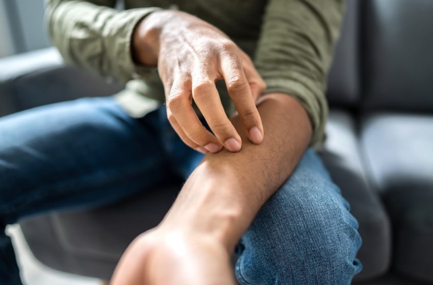  Sexually transmitted fungal infection outbreak hits Minnesota