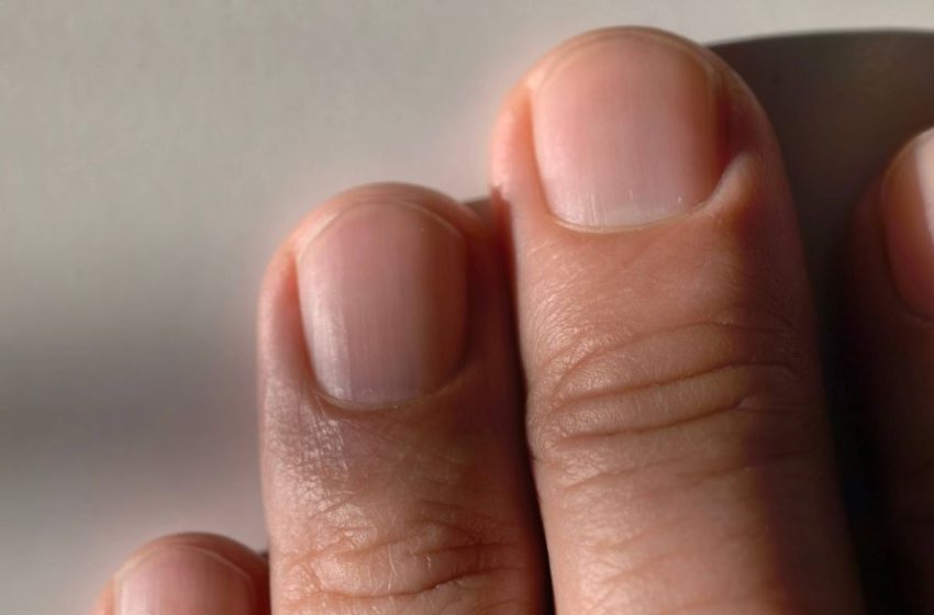  Finger symptom could be heart failure warning sign