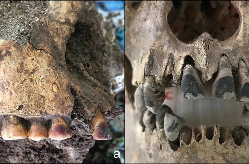  2,000 years ago, people in Vietnam used iron to permanently blacken their teeth | World News